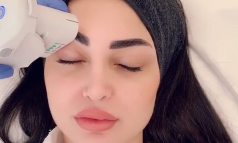 تعرفي على تقنية Ultherapy مع الدكتور رامي عبادي